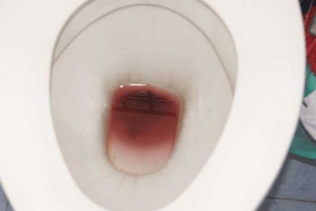 Spotting bei Männer wann se opgereegt sinn